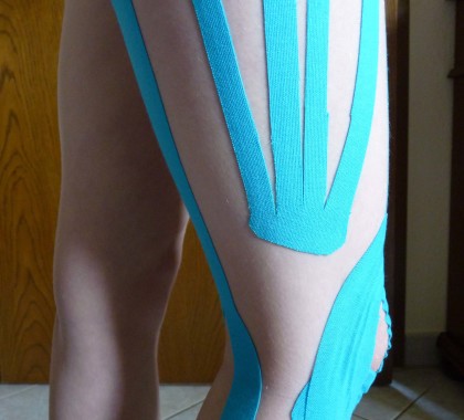 Kinesio Taping